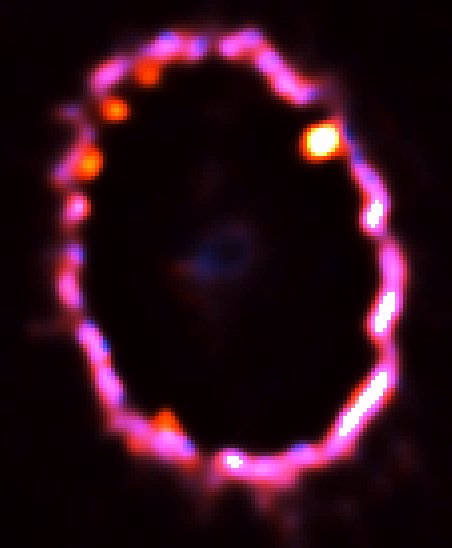 Remnant of Supernova 1987a